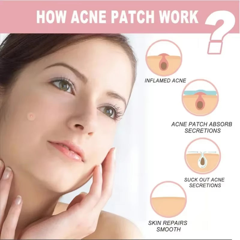 72/180Pcs Hydrocolloid Acne Patch Waterproof Acne Removing PU Film Face Printing Spots Marks Invisible Acne Cleansing Patch