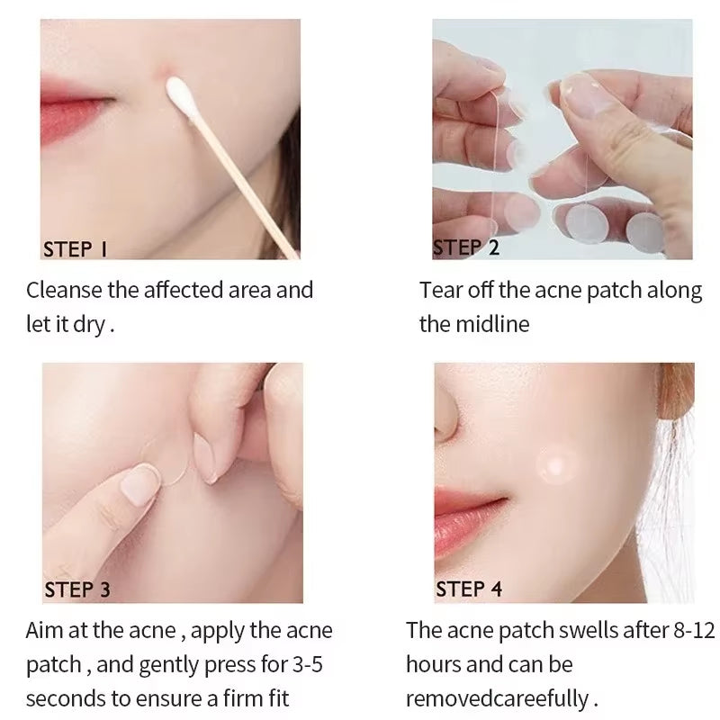 72/180Pcs Hydrocolloid Acne Patch Waterproof Acne Removing PU Film Face Printing Spots Marks Invisible Acne Cleansing Patch